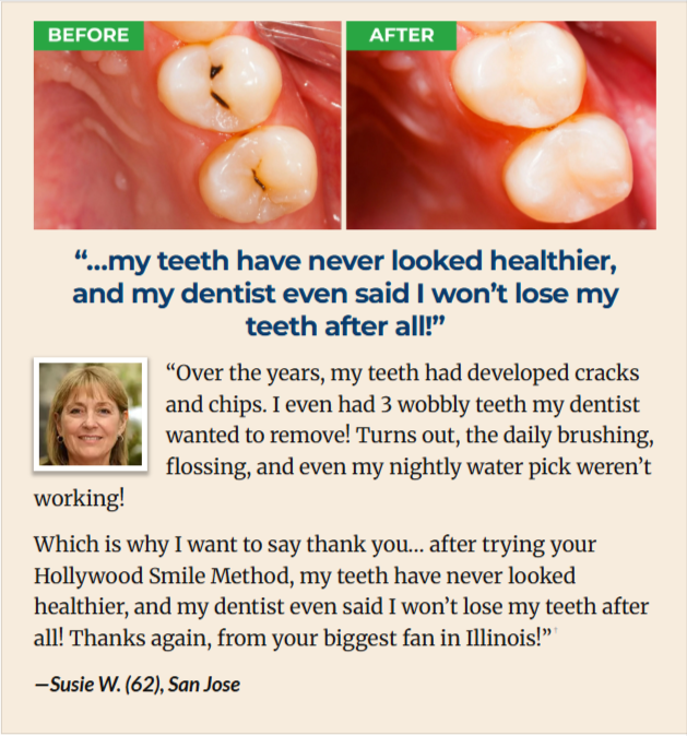 ProXental Customer Reviews